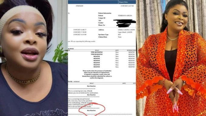 Dayo amusa shares updated result 860x573